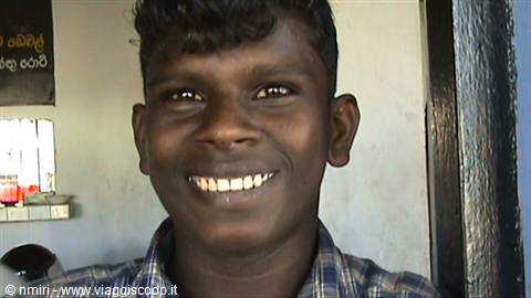 Sorriso a 32 denti